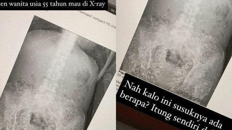 Ratusan susuk terdeteksi