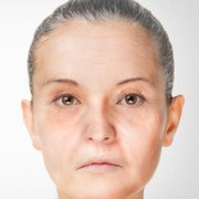 Jangan Sampai Terjadi Padamu, Segera Hindari Penuaan Dini dengan Cara Ini!