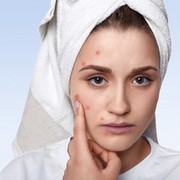 Hindari! Ini 5 Kebiasaan yang Sebabkan Breakout