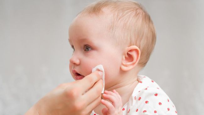 7 Obat Rumahan untuk Obati Ruam di Wajah Bayi