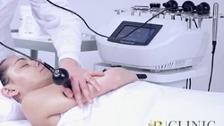 Tubuh Ideal bak Selebriti Indonesia Bisa Didapatkan lewat RF Sineson