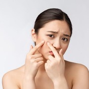 6 Kandungan Skincare yang Perlu Dihindari Kulit Berjerawat