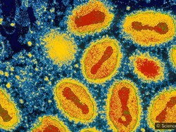 Deretan Virus Mematikan yang Muncul Lalu Menghilang Tanpa Jejak
