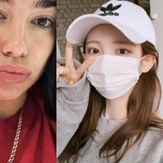 Tips dan Trik Mencegah Munculnya Jerawat karena Sering Pakai Masker