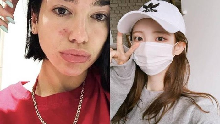 Tips dan Trik Mencegah Munculnya Jerawat karena Sering Pakai Masker