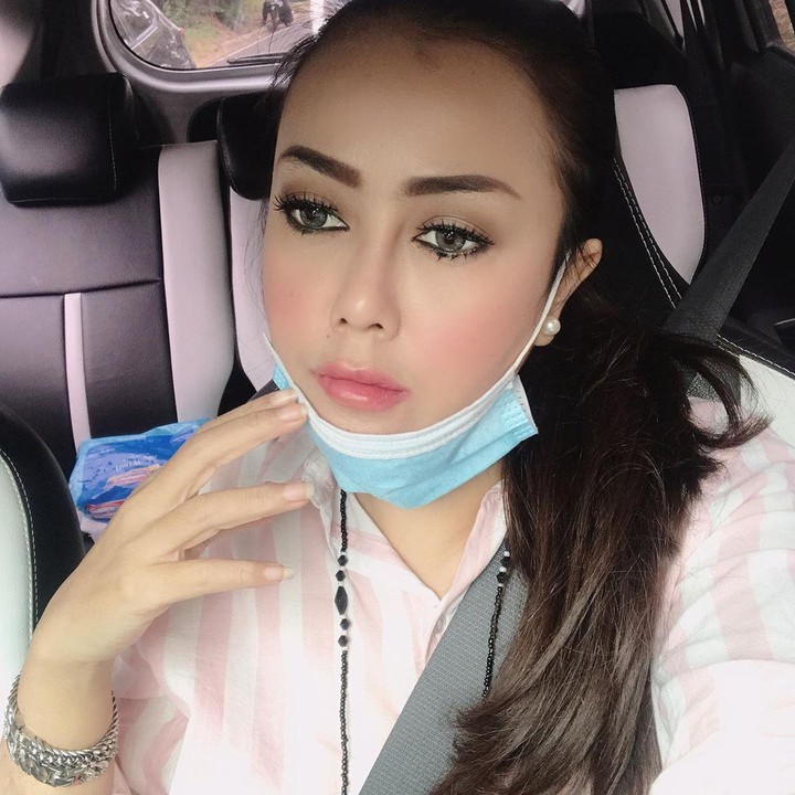 <p>Saat itu Rency melakukan perawatan filler. Usai perawatan, dagunya malah bengkak dan bibirnya bernanah. (Foto: Instagram @rency_milano)</p>