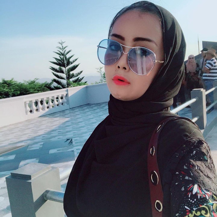 <p>Dagu dan bibir Rency pun dioperasi untuk dipulihkan. (Foto: Instagram @rency_milano)</p>