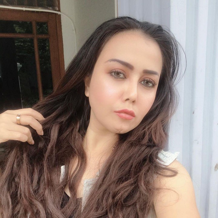 <p>"Ngak apa cacat juga, ikhlas aja yah," tulis Rency di Instagramnya. (Foto: Instagram @rency_milano)</p>