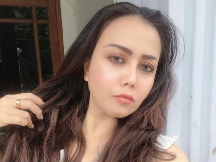 7 Potret Terbaru Rency Milano Usai Jadi Korban Malapraktik, Bentuk Dagu Jadi Sorotan