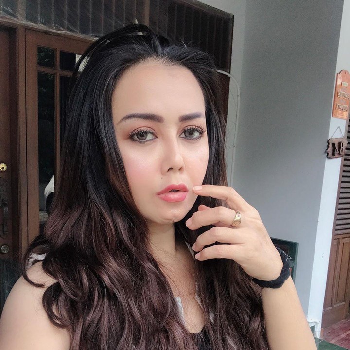 <p>Pada bulan Juli lalu, Elma Theana mengabarkan bahwa kakaknya, Rency Milano menjadi korban malapraktik di salah satu klinik kecantikan di Jakarta. (Foto: Instagram @rency_milano)</p>
