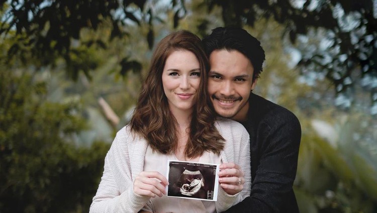Randy Pangalila Umumkan Istri Hamil Anak Pertama