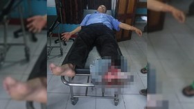 Anggota TGPF Tertembak di Papua Dosen UGM Bambang Purwoko