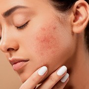 Buat Kamu yang Sering Gonta-Ganti Skincare, Ini Dampak Buruk yang Gak Kamu Sadari