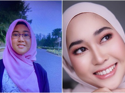 Dokter Gigi Pamerkan Wajah 10 Tahun Lalu, Berubah Cantik karena Lakukan Ini