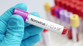 Beda Norovirus dan Covid: Gejala, Penularan, dan Pengobatan