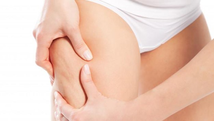 Awas! 5 Kebiasaan Sepele Ini Bisa Sebabkan Timbulnya Selulit