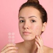 Cara Mudah dan Simpel untuk Menghilangkan Jerawat Batu