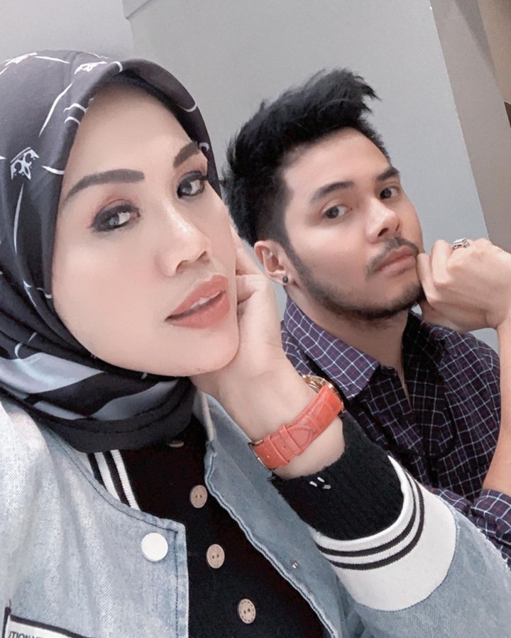 7 Foto Elly Sugigi Usai Perawatan & Potong Gigi, Mengaku Mirip Adelia