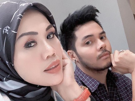 7 Foto Elly Sugigi Usai Perawatan & Potong Gigi, Mengaku Mirip Adelia Pasha
