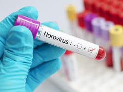Lebih dari 1.500 Warga Inggris Terinfeksi Norovirus, Alami Demam hingga Muntah