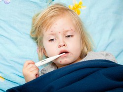 Laporan WHO dan CDC: Hampir 40 Juta Anak Rentan Terkena Campak