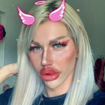 Penampilan Layaknya Boneka Barbie, Pria Ini Ngaku Masih Normal