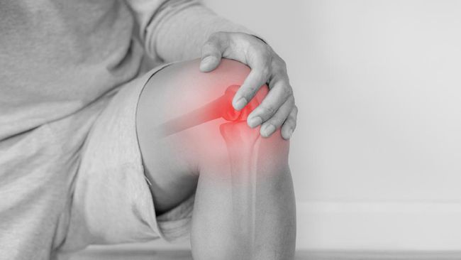Hari Arthritis Sedunia dirayakan setiap 12 Oktober. Arthritis disebut juga radang sendi. Jadi apa beda radang sendi dan nyeri sendi?
