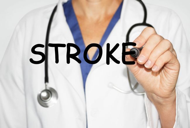 Meluruskan 3 Mitos Soal Stroke