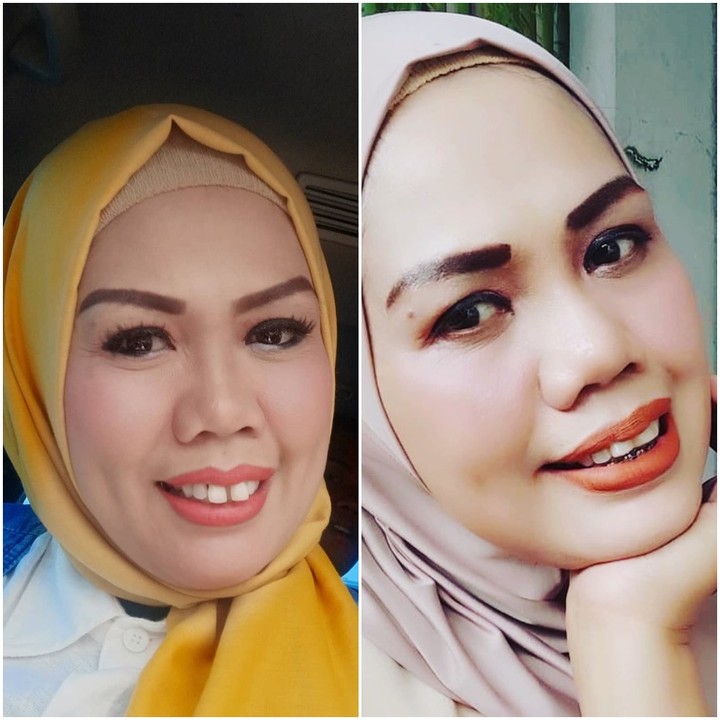 7 Potret Transformasi Cantik Elly Sugigi Sebelum & Sesudah Potong Gigi