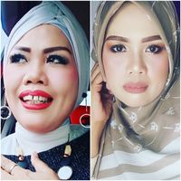 7 Potret Transformasi Cantik Elly Sugigi Sebelum & Sesudah Potong Gigi ...