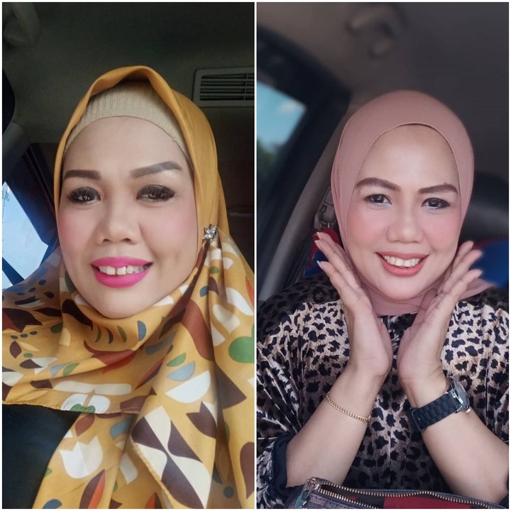 7 Potret Transformasi Cantik Elly Sugigi Sebelum & Sesudah Potong Gigi