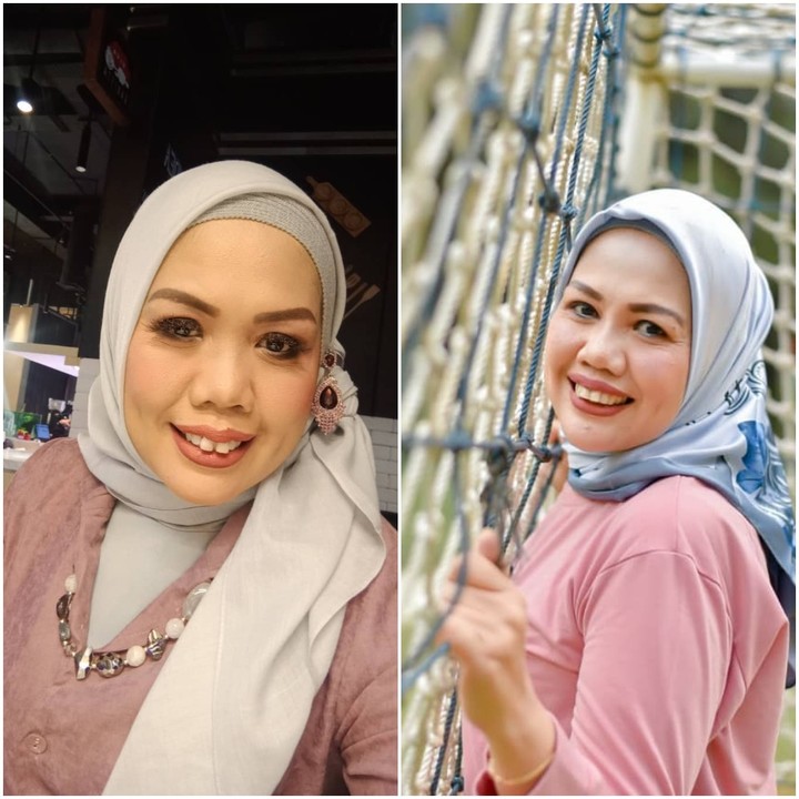 7 Potret Transformasi Cantik Elly Sugigi Sebelum & Sesudah Potong Gigi