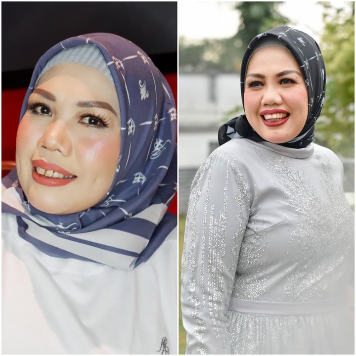 7 Potret Transformasi Cantik Elly Sugigi Sebelum & Sesudah Potong Gigi