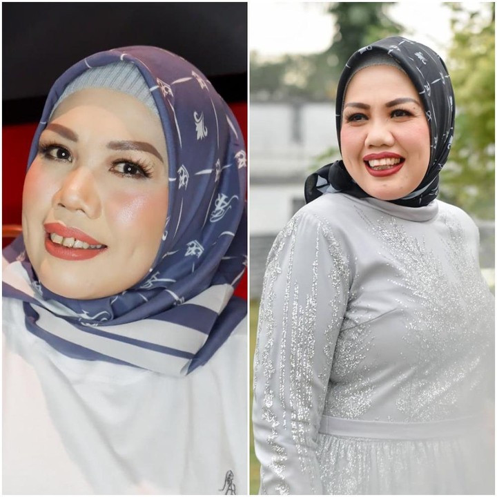 <p>Ternyata keputusannya untuk memotong giginya adalah keputusan tepat, karena Elly kini tampil lebih memesona. (Foto: Instagram @ellysugigi_real_)</p>