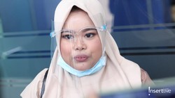 Filler Hidung, Tampilan Baru Kekeyi Jadi Sorotan