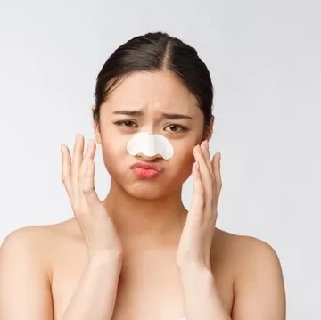 6 Skincare Lokal untuk Mengatasi Komedo di Bawah Rp100 Ribu