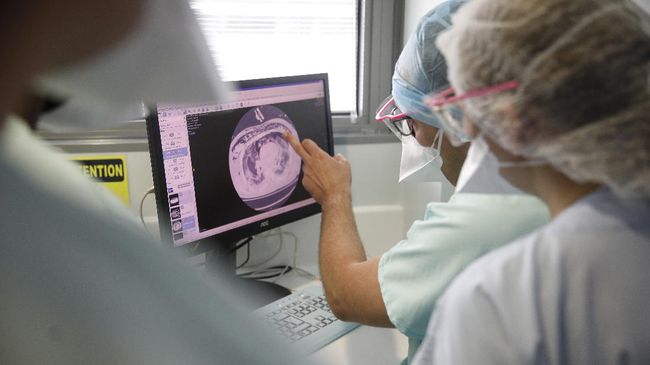 Pemeriksaan kesehatan menyeluruh atau medical check up saat pandemi Covid-19 penting dilakukan untuk memastikan memiliki komorbid atau tidak.