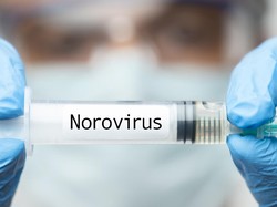 Ratusan Penumpang Kapal Pesiar Mewah di AS Kena Norovirus, Begini Gejalanya