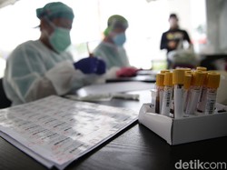 Temuan Kasus Turun Tajam, Ini Riwayat Tes COVID-19 RI Saat Libur Panjang