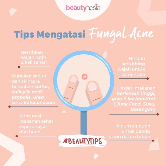 Infografis - Tips Mengatasi Fungal acne