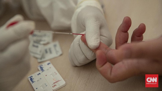 Meskipun demikian, KPU mempersilakan pemerintah daerah yang ingin melakukan tes swab kepada para penyelenggara Pilkada 2020.