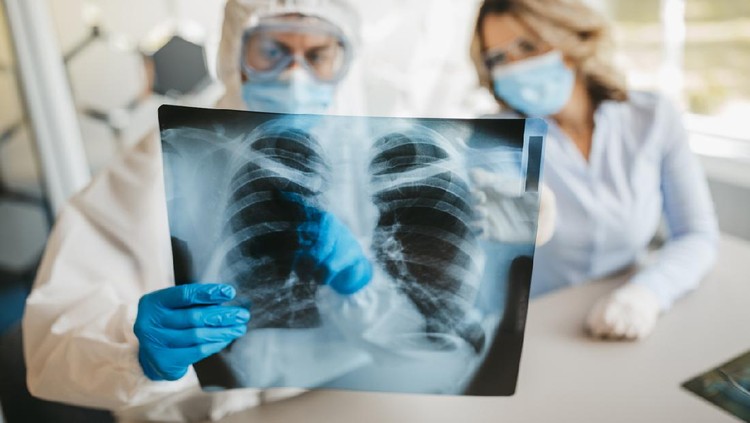 Male and female doctor looking at lungs x-ray in hospital during covid19 pandemic