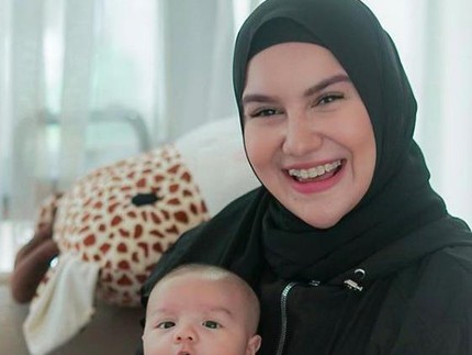 Irish Bella Hilangkan Gigi Gingsul yang Ikonik, Begini Penampilannya Kini
