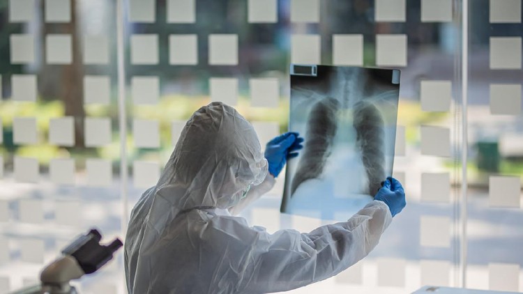 Film chest x-ray PA upright : show normal human's chest.