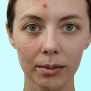 Kulit Wajah Bertekstur? Berikut Cara Mengatasinya!