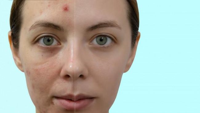 Cara Glowingkan Muka Kulit Wajah Bertekstur? Berikut Cara Mengatasinya!