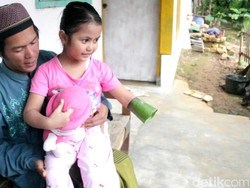 Anak Guru Ngaji di Sukabumi Ini Menabung Uang Jajannya Demi Tangan Palsu