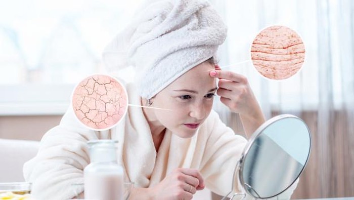 Beda Sama Kering, Ini Penyebab Kulit Wajah Dehidrasi dan Ciri-Cirinya!