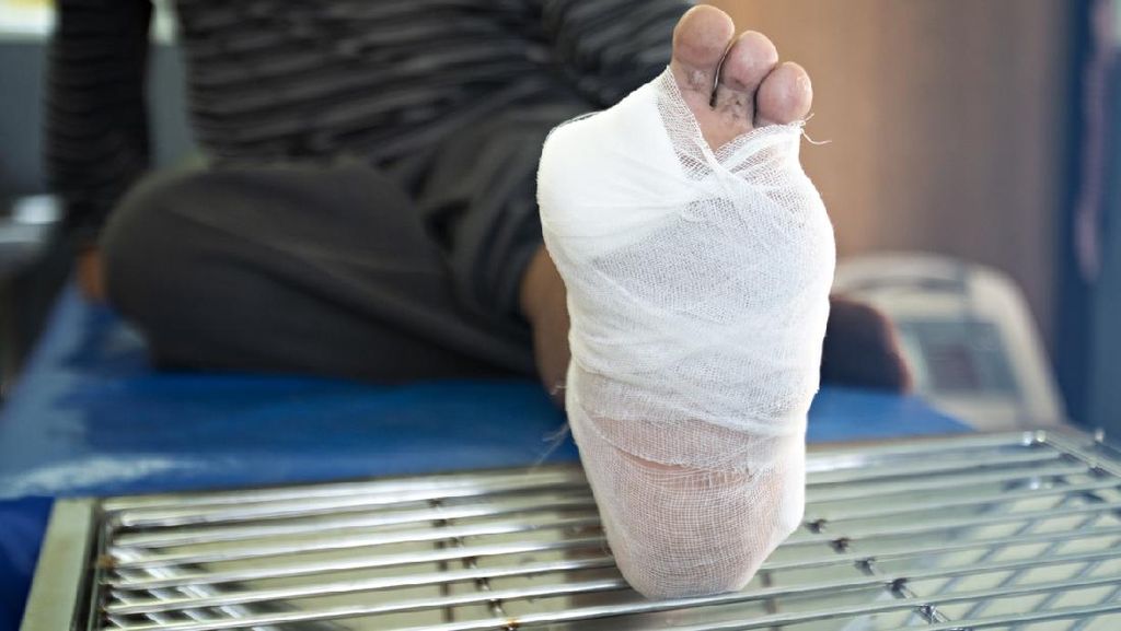 5 Cara Merawat Luka Diabetes untuk Cegah Infeksi Berat