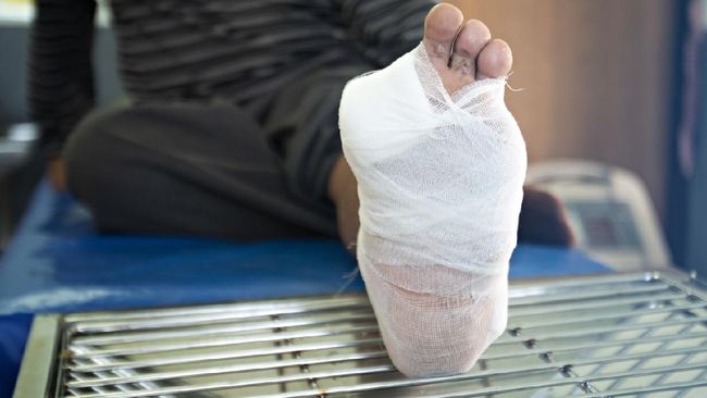 Diabetes dapat mempengaruhi setiap bagian tubuh, termasuk kulit. Berikut gejala diabetes pada kulit.